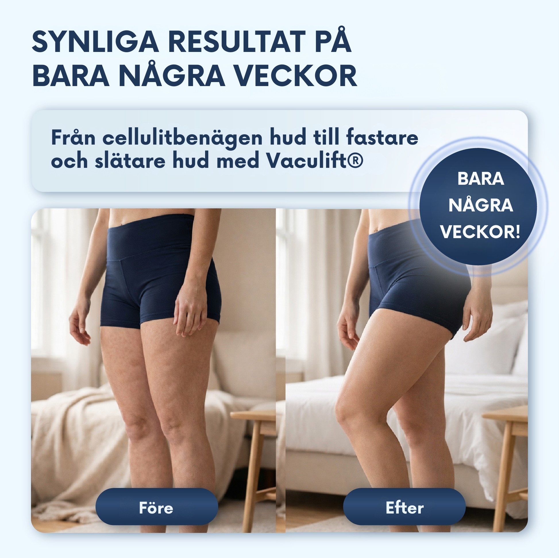 Noveya VacuLift® – Massageapparat mot celluliter